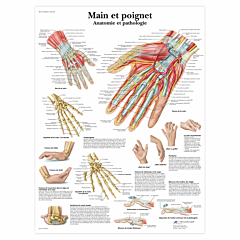 Planche anatomique Main et poignet : anatomie et pathologie