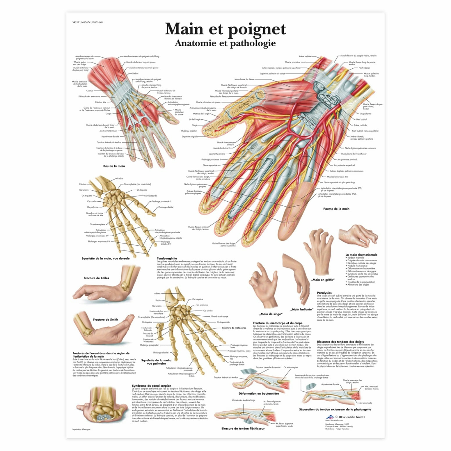 Planche anatomique Main et poignet : anatomie et pathologie