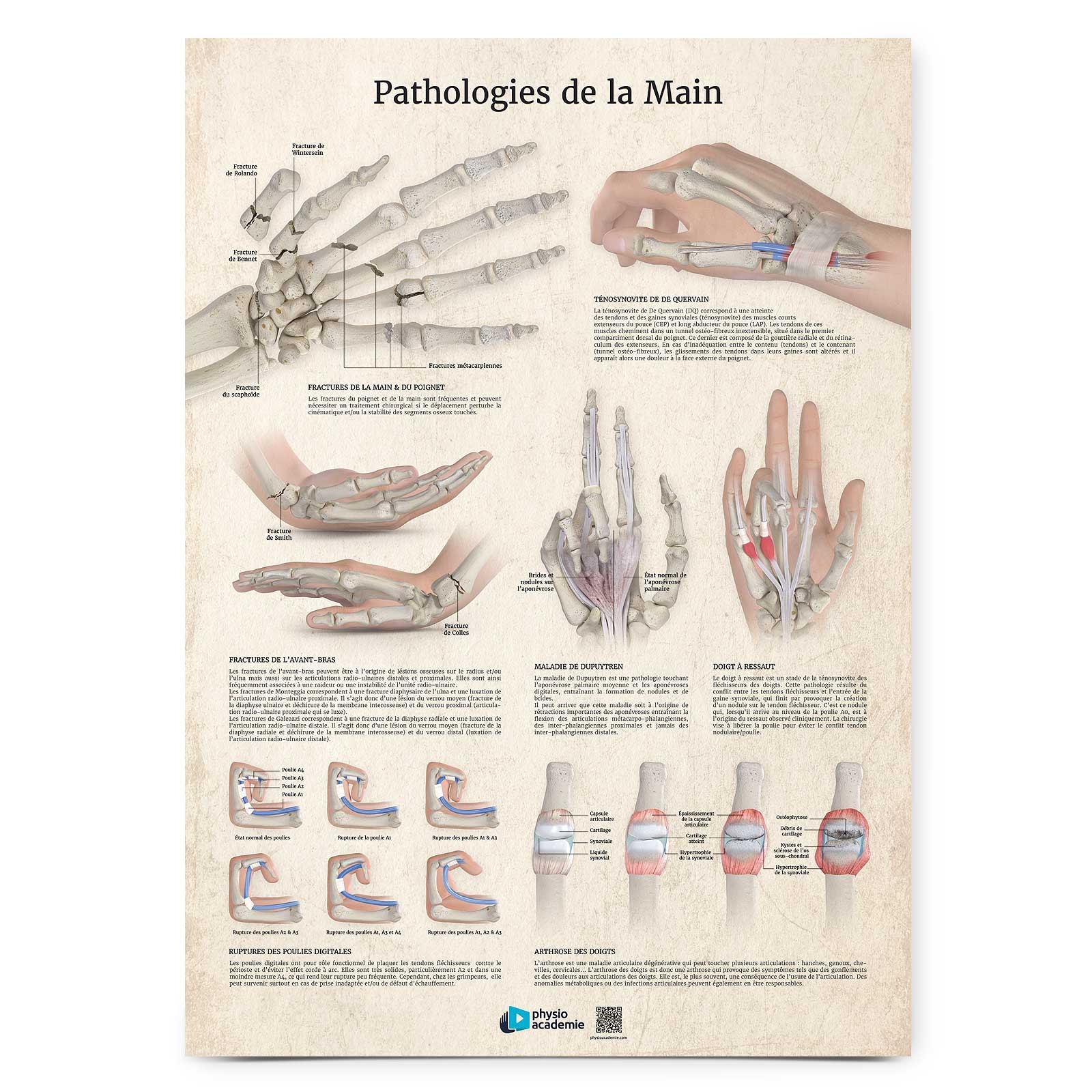Poster Planche anatomique Pathologies de la Main