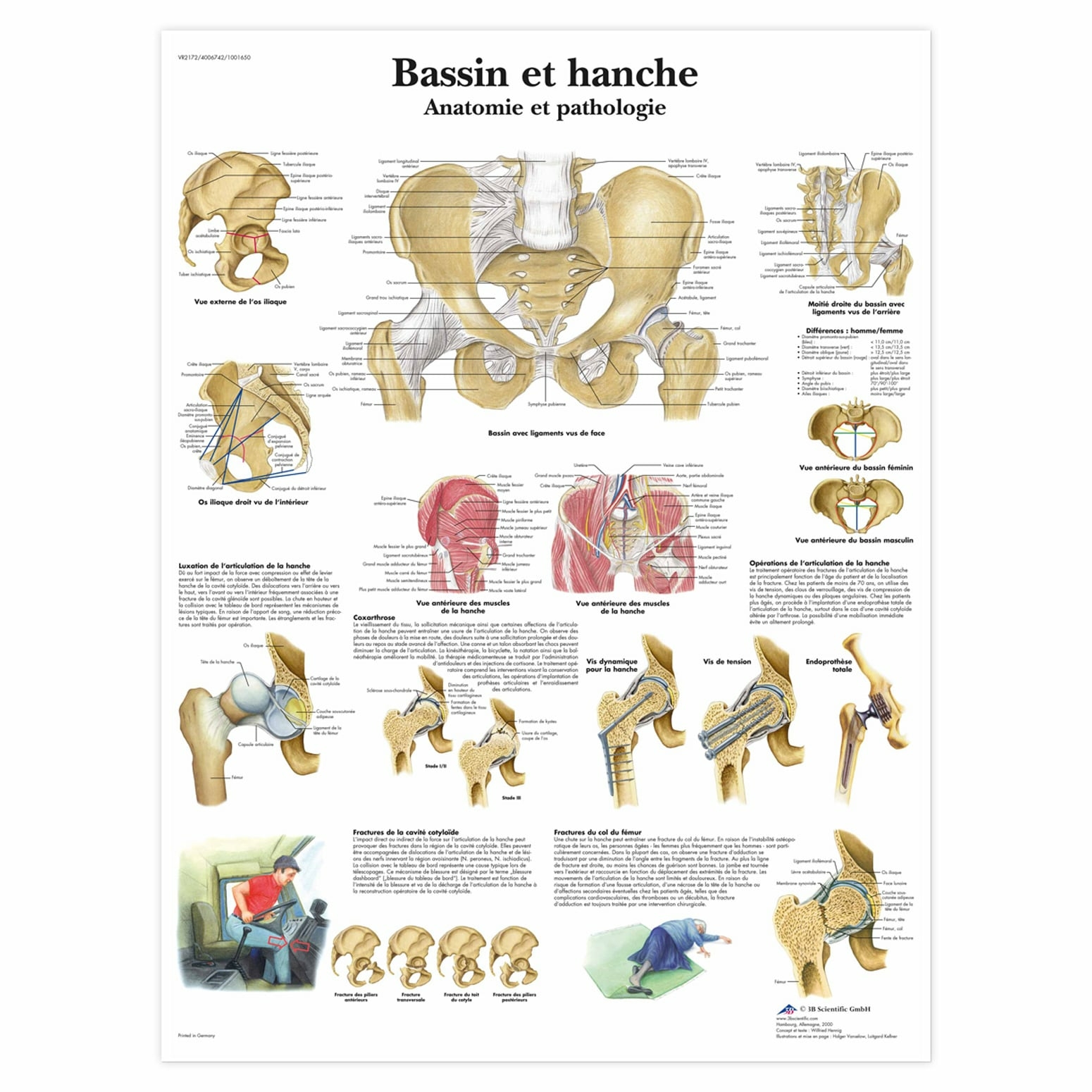 Planche anatomique Bassin et hanche, anatomie et pathologie