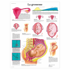Planche anatomique \"La grossesse\"