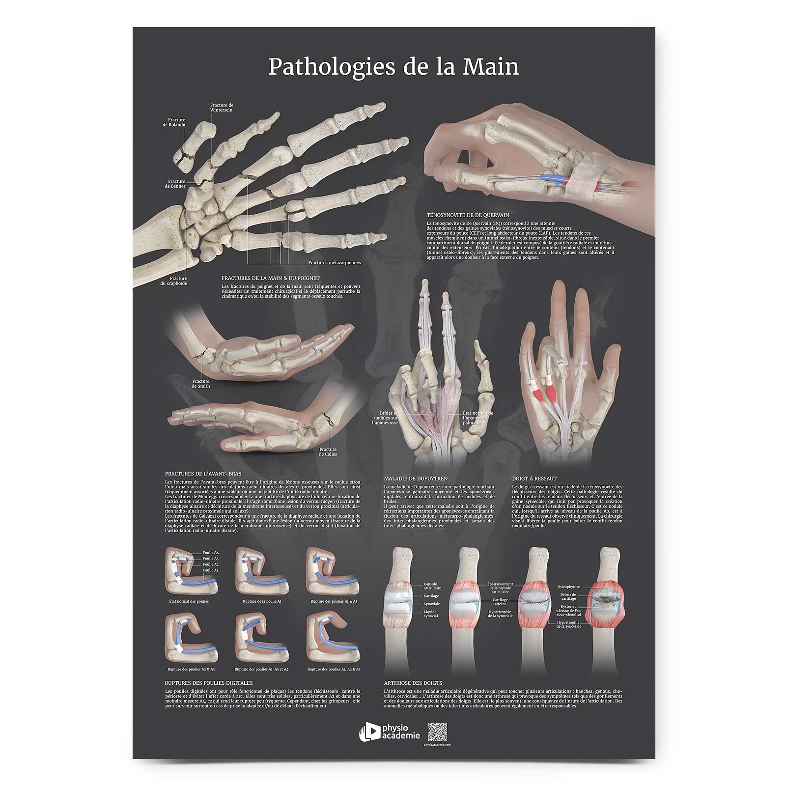 Pathologies de la Main - Planche PVC 50 x 70 cm - Gris anthracite