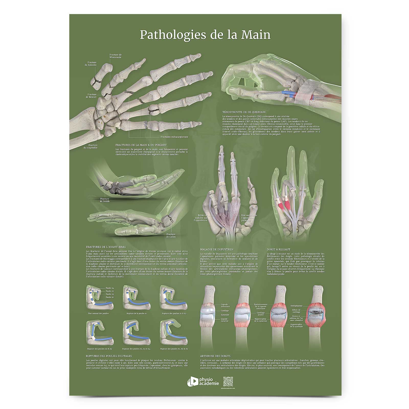 Pathologies de la Main - Planche PVC 50 x 70 cm - Vert